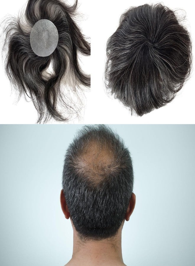 Voloria Bald Spot Hair Patch Toupee for Men 3.15x3.15inches Full PU Skin Base Cover-up Human Hair Topper Replacement Systems Hairpiece (1B Black Mixed 20% Grey Color) - Image 1